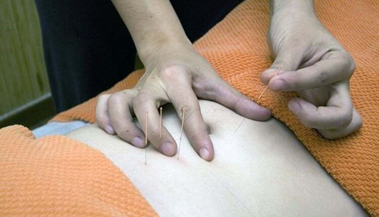 How Acupuncture Can Help Your Body