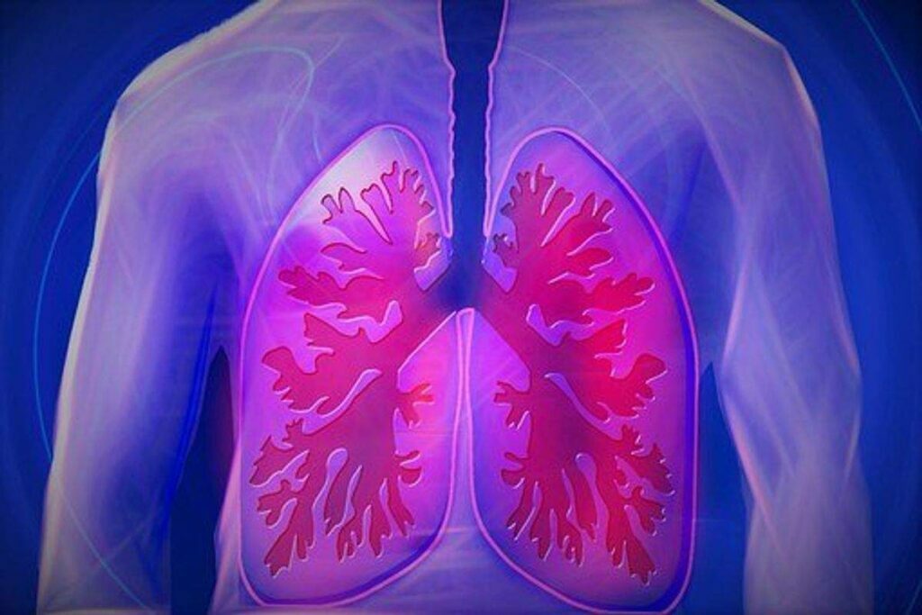 Recovering From Lung Surgery