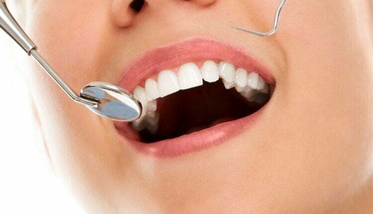 bhandari dental