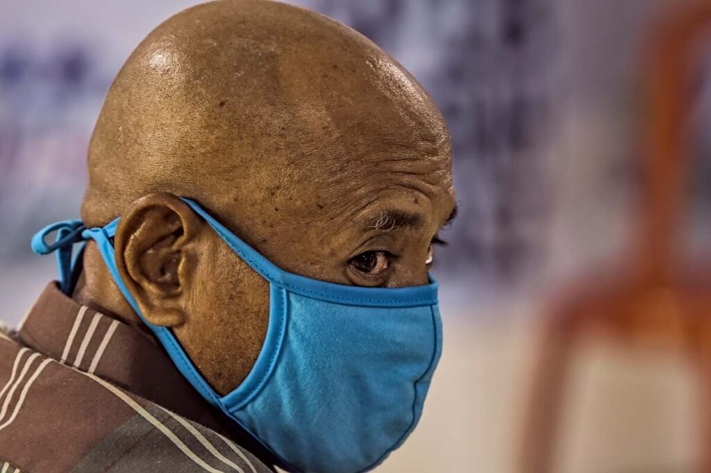 Beard transplant